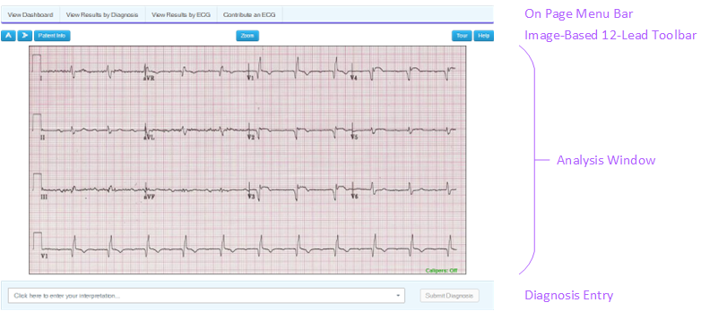Example Image Based 12-Lead Diagnostic ECG User Interface