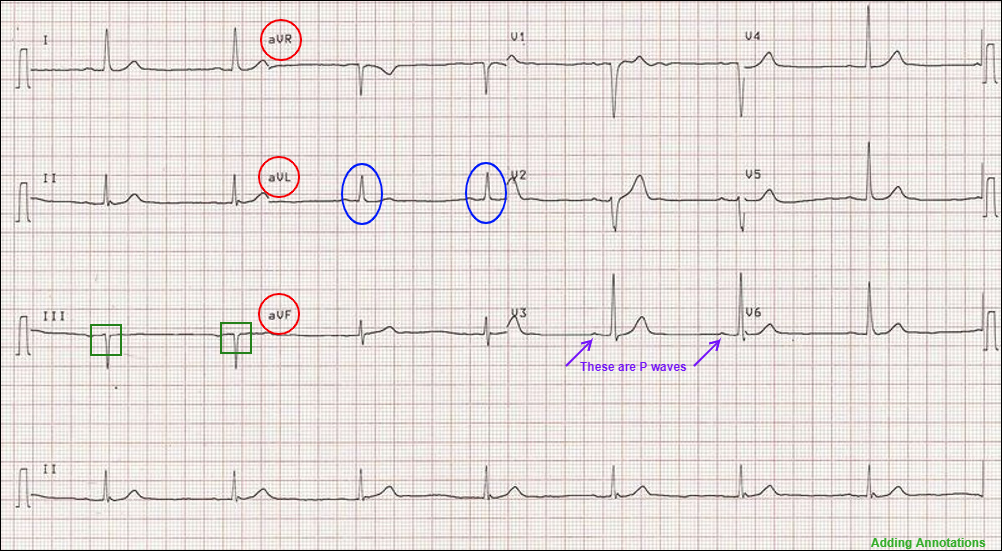 Examples of Various Annotations