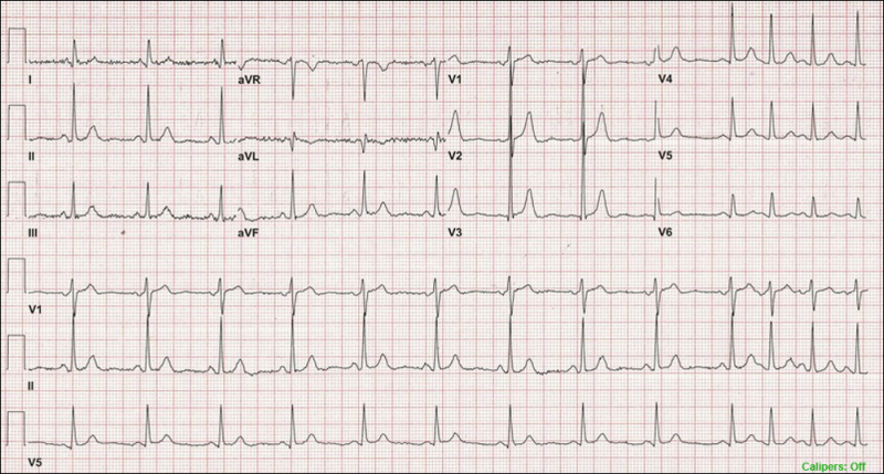 An Example of an Image-Based Diagnostic 12-Lead ECG