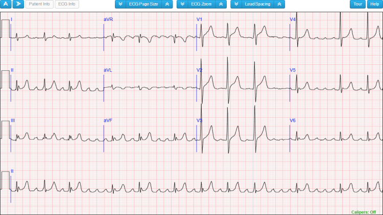 The Results ECG Section for Data-Based 12-Lead Diagnostic ECGs